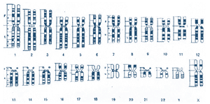 Schematische Darstellung von gebänderten Chromosomen